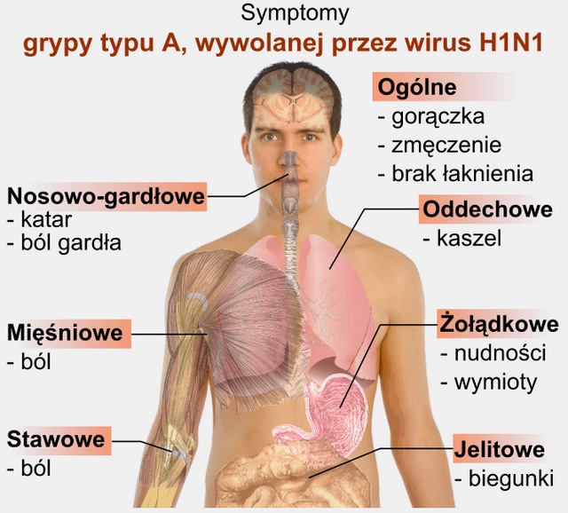 Grypa A/H1N1 symptomy objawy Grypa A/H1N1 symptomy objawy